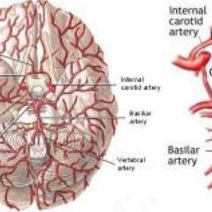 Vaskularne bolesti mozga
