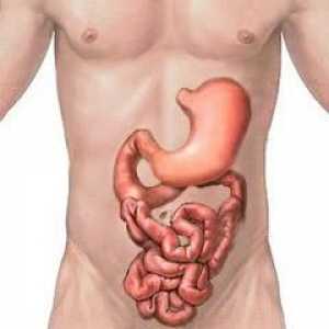 Spastički kolitis debelog crijeva