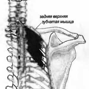 Bol u leđima uzrokovana serratus