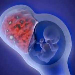 Formiranje utero-posteljice cirkulacije