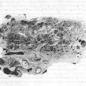 Stromalne komponente gušterače