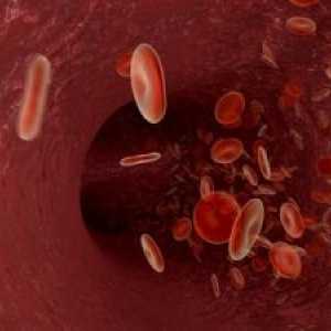 Transfuzija krvi i krvnih proizvoda u djece