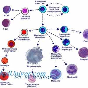 Transplantacija matičnih stanica u mijeloproliferativnih bolesti mieloleykoze