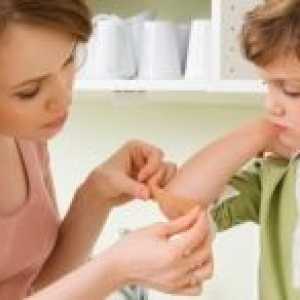 Traumatskog krvarenja u djece, simptomi, liječenje, uzroci