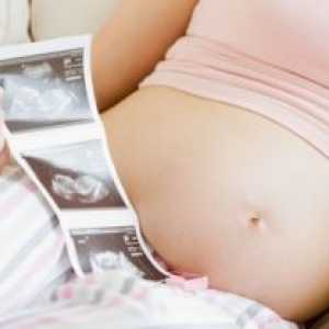 Uske zdjelice tijekom trudnoće