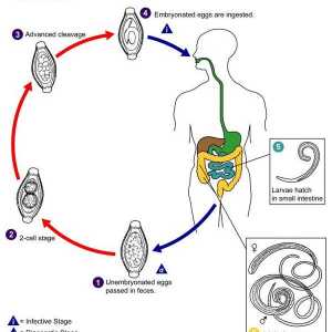 Whipworm patogenima trihotsefaleze, načina infekcije, simptomi i liječenje bolesti kod djece i…