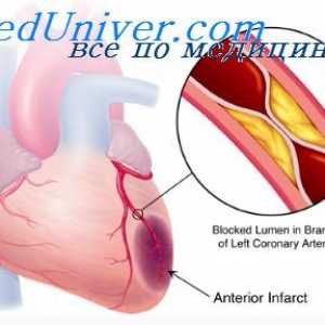 Unutarnje karotidne arterije embrija. Luk aorte i plućne arterije fetusa