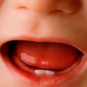 Visoka temperatura i proljev, a dobivanje zuba u djece