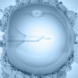Zatvor nakon prijenosa embrija (IVF)