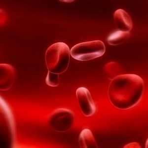 Zhelezorefrakternaya anemija